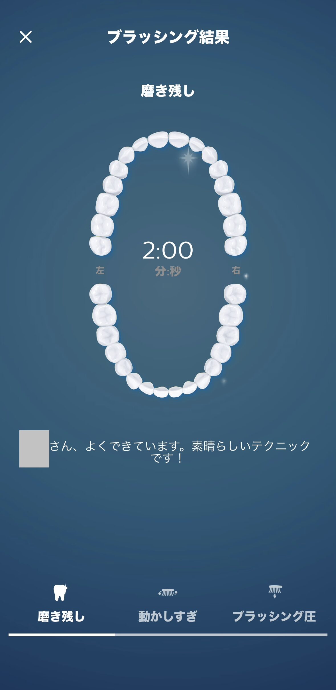 ソニッケアーアプリでブラシ交換時期を管理する画面